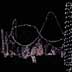 Christmas Lights